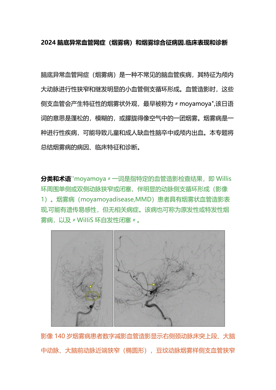 2024脑底异常血管网症(烟雾病)和烟雾综合征病因、临床表现和诊断.docx_第1页