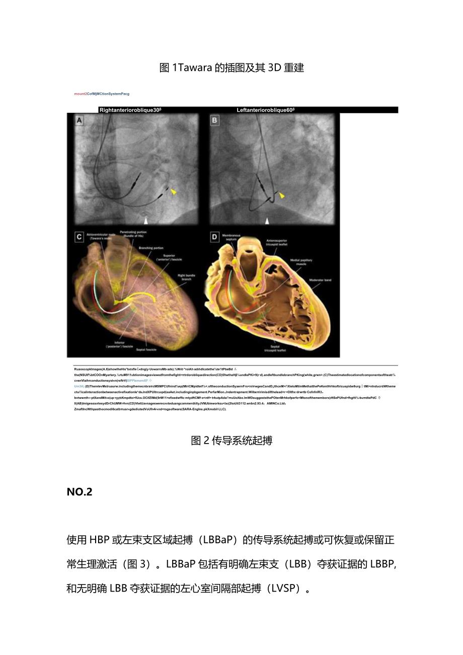 心脏传导系统起搏领域最新研究进展2024.docx_第2页