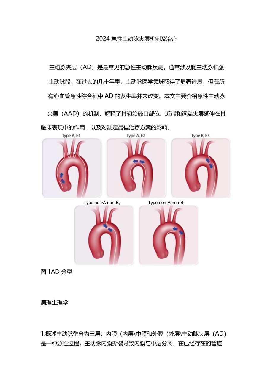 2024急性主动脉夹层机制及治疗.docx_第1页