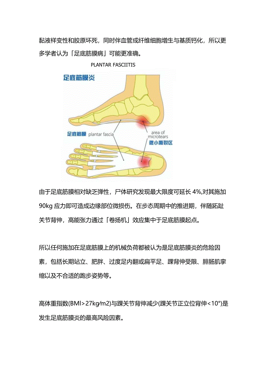 2024足底筋膜炎的诊断与治疗.docx_第2页