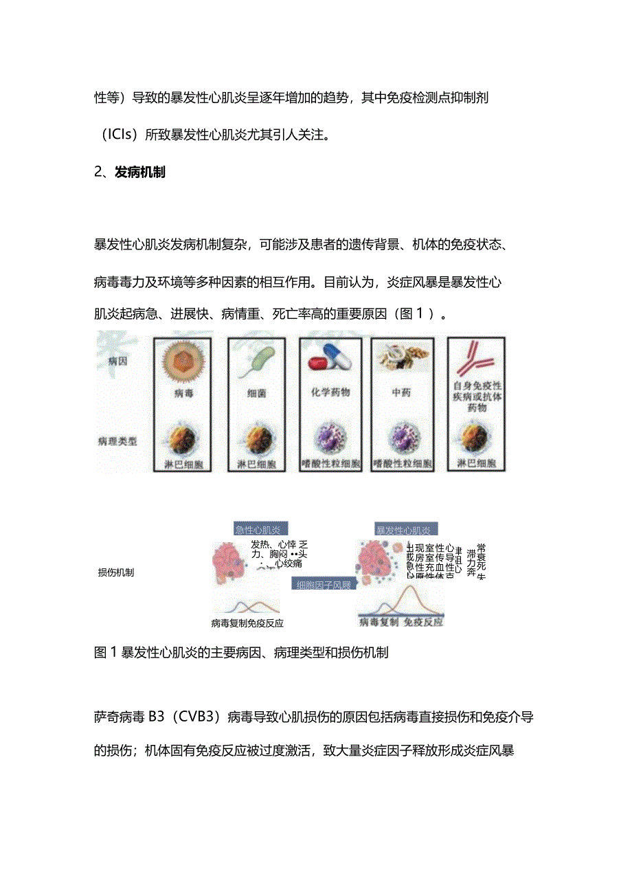 2024中国成人暴发性心肌炎诊断和治疗指南.docx_第2页