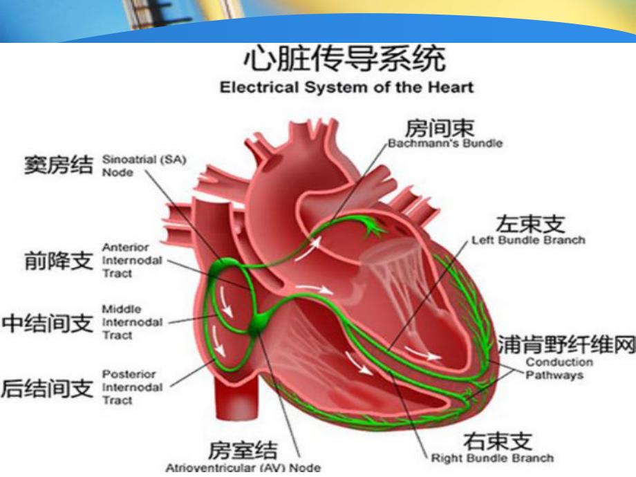 心脏起搏器原理及手术护理.ppt_第2页