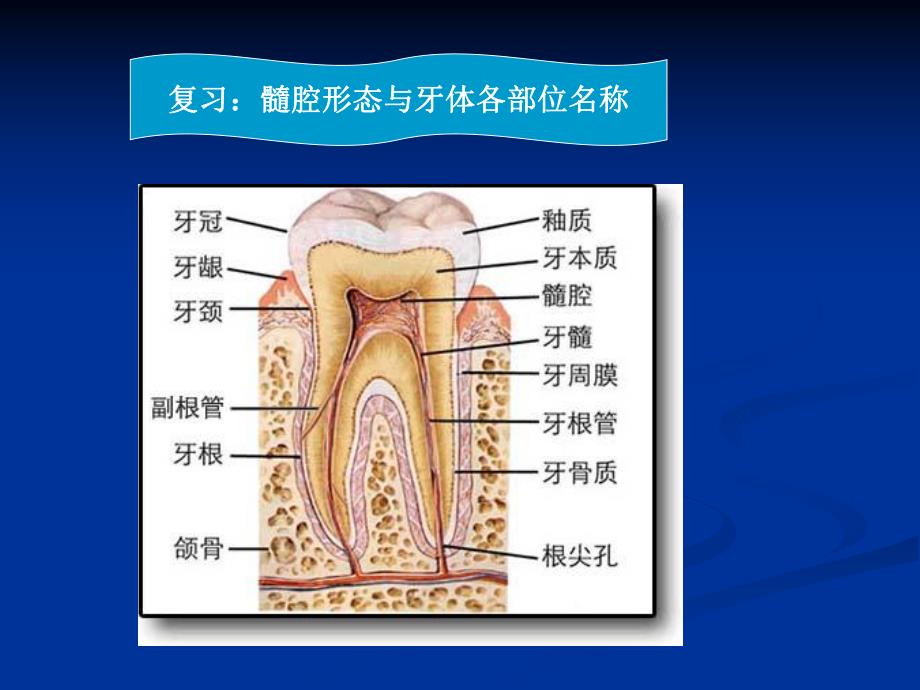 急性牙髓炎.ppt_第3页