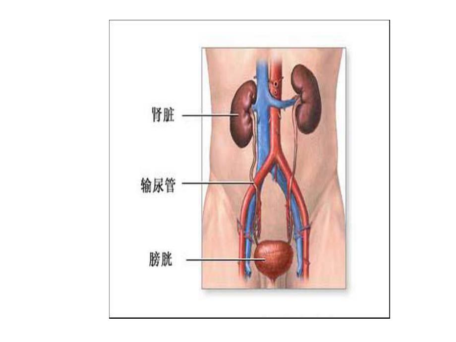 尿路感染病人的护理1.ppt_第3页