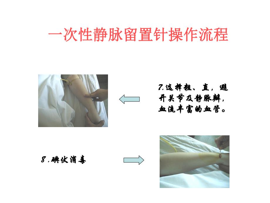 一次性静脉留置针操作流程.ppt_第3页