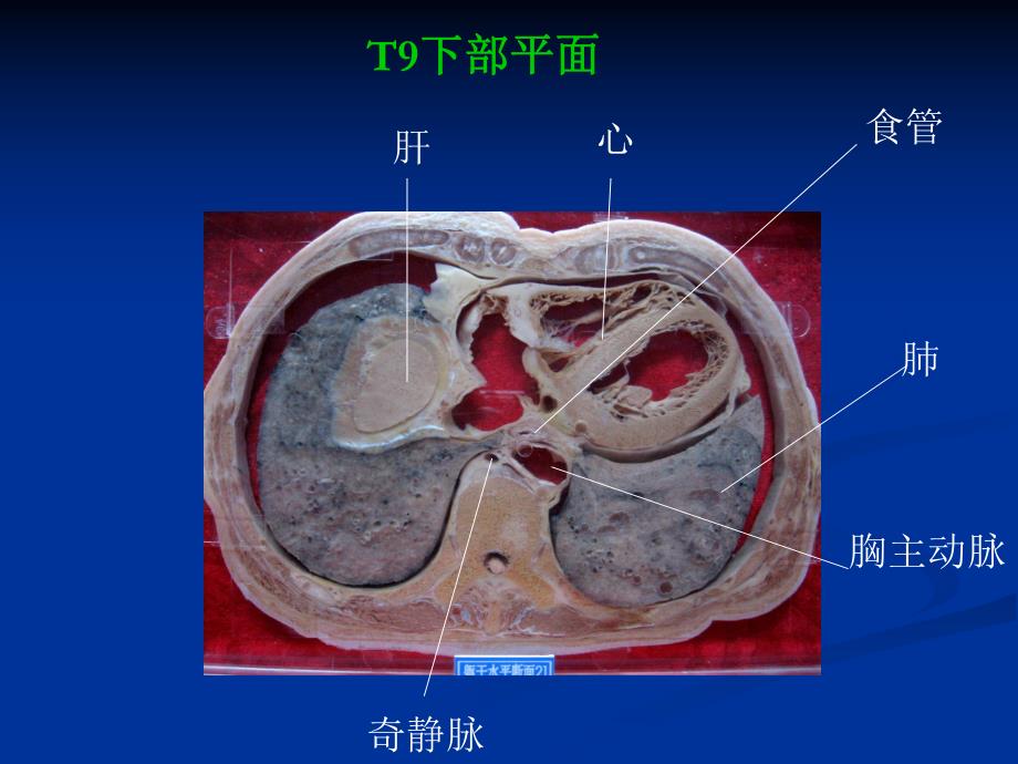 断层解剖 高清图.ppt_第2页