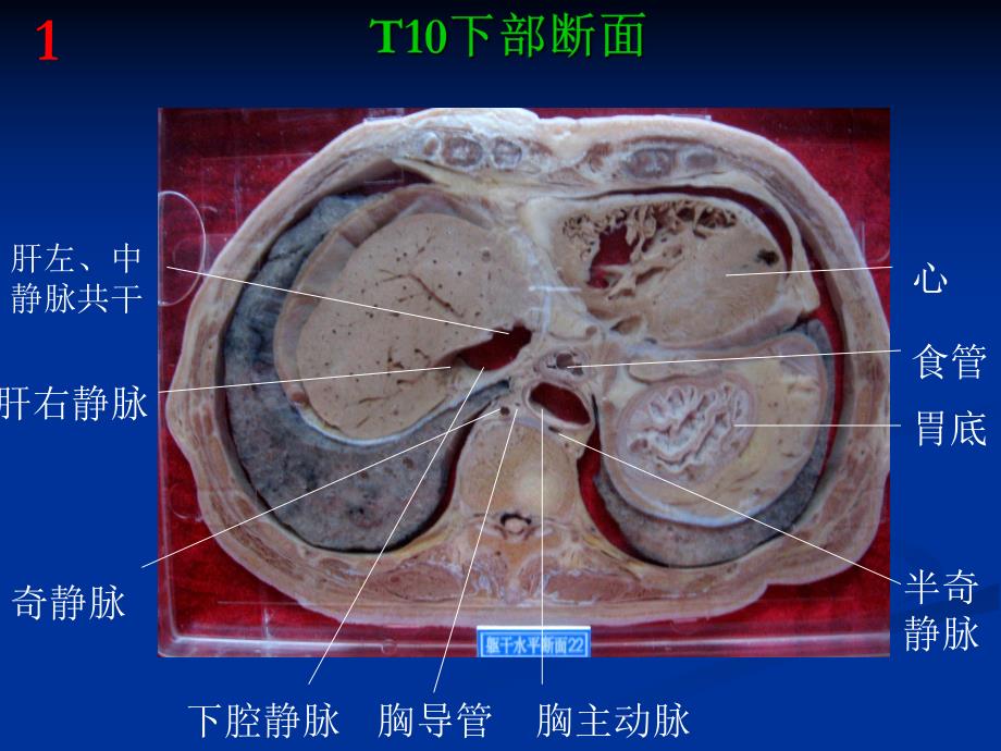 断层解剖 高清图.ppt_第3页