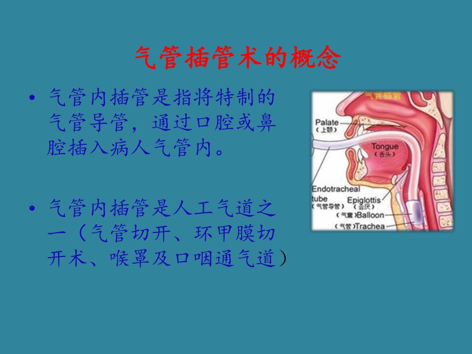 成人经口气管插管术.ppt_第3页