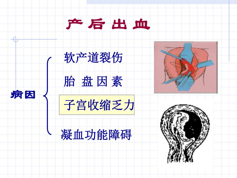 母婴护理.ppt_第3页