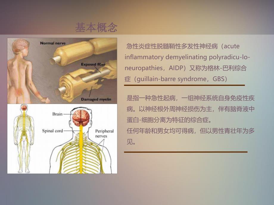 格林巴利综合症的护理查房.ppt_第3页