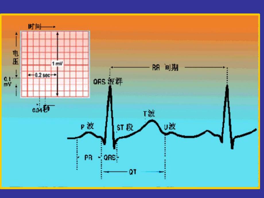 正常、异常心电图护理识别技巧.ppt.ppt_第3页