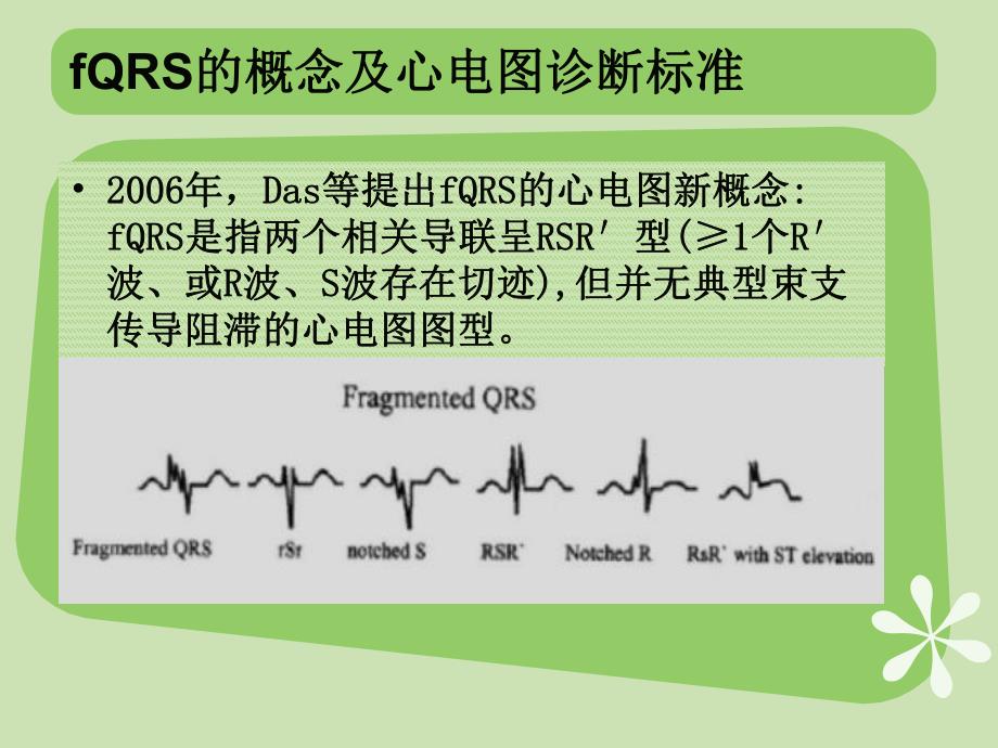 碎裂QRS波.ppt_第3页