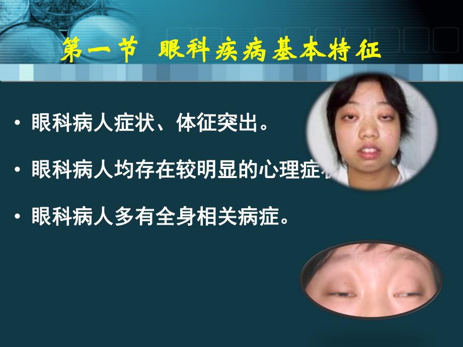 眼科护理概述.ppt_第2页