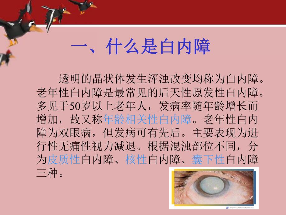 眼科常见疾病病人治疗及护理.ppt.ppt_第3页