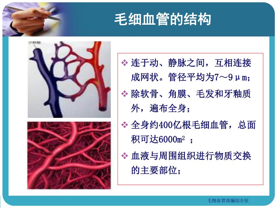 毛细血管渗漏综合征图文.ppt_第3页