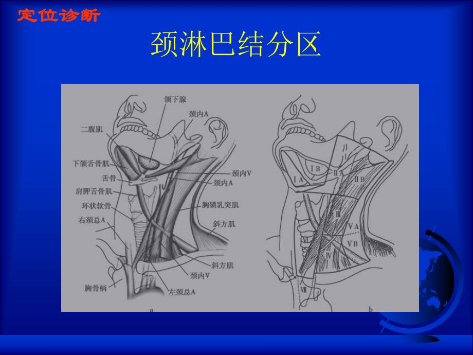 浅表淋巴结定位定性超声诊断.ppt_第3页