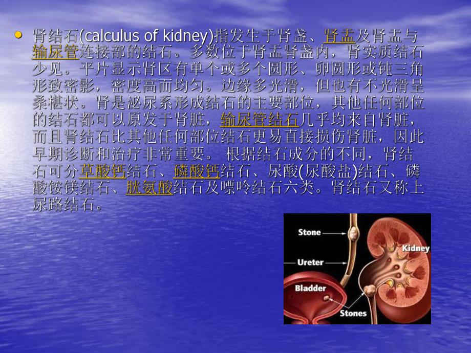 肾结石.ppt1.ppt_第3页