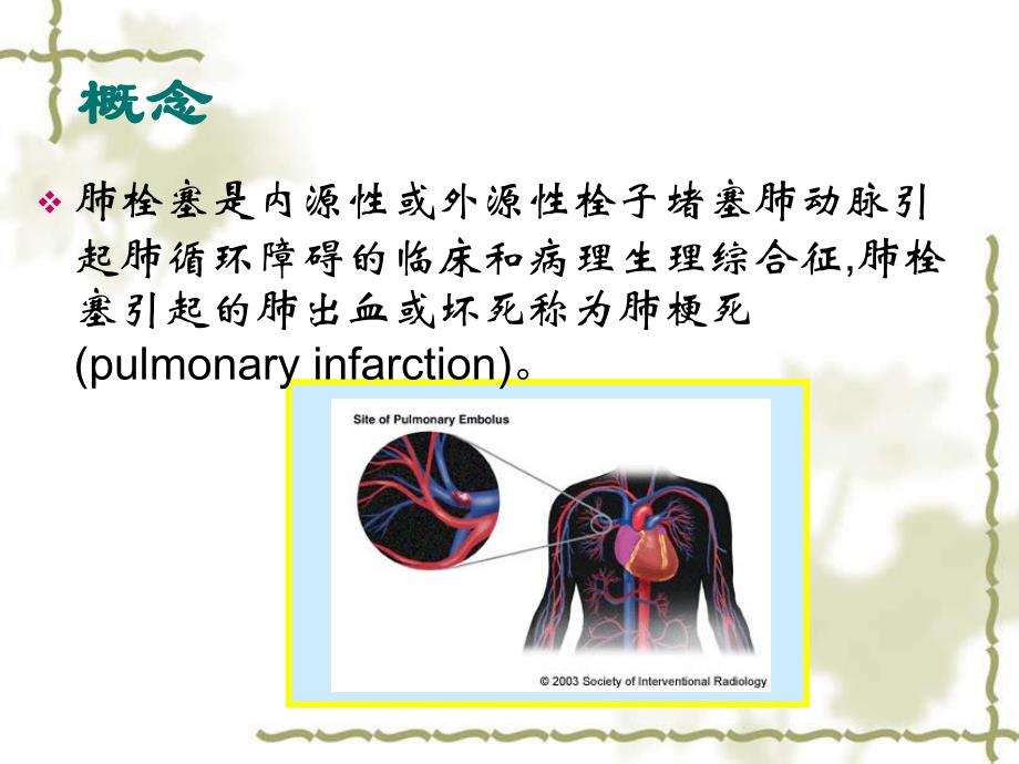 肺栓塞的诊断与治疗.ppt_第2页