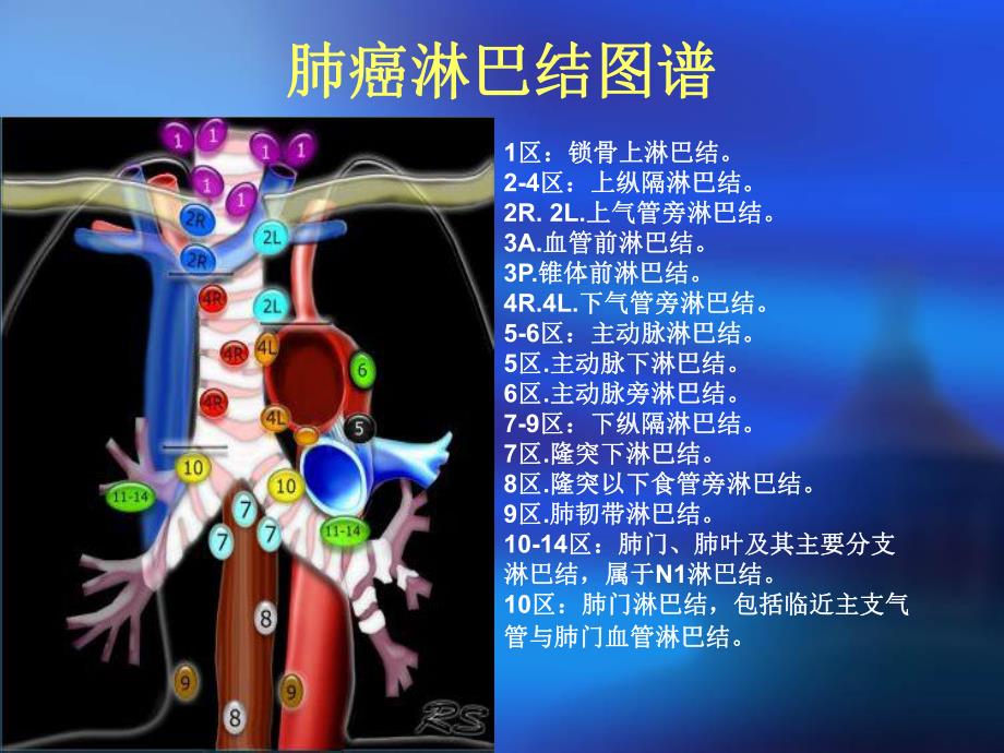 肺癌淋巴结图谱.ppt.ppt_第3页