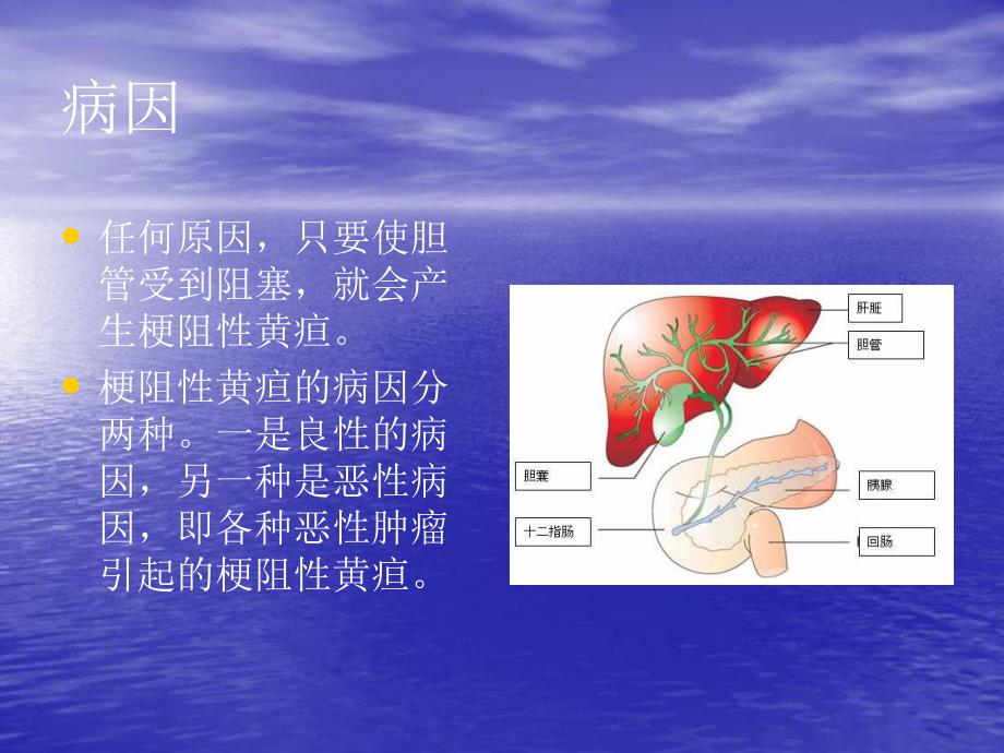 肝外阻塞性黄疸的微创治疗进展.ppt_第3页