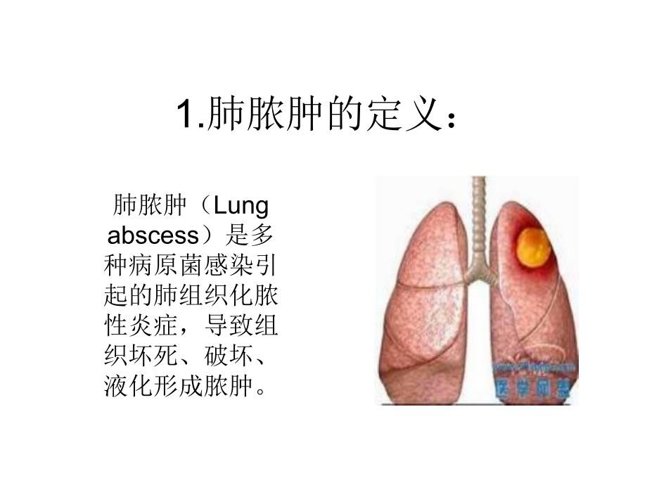 肺脓肿疾病病人的护理查房.ppt_第2页