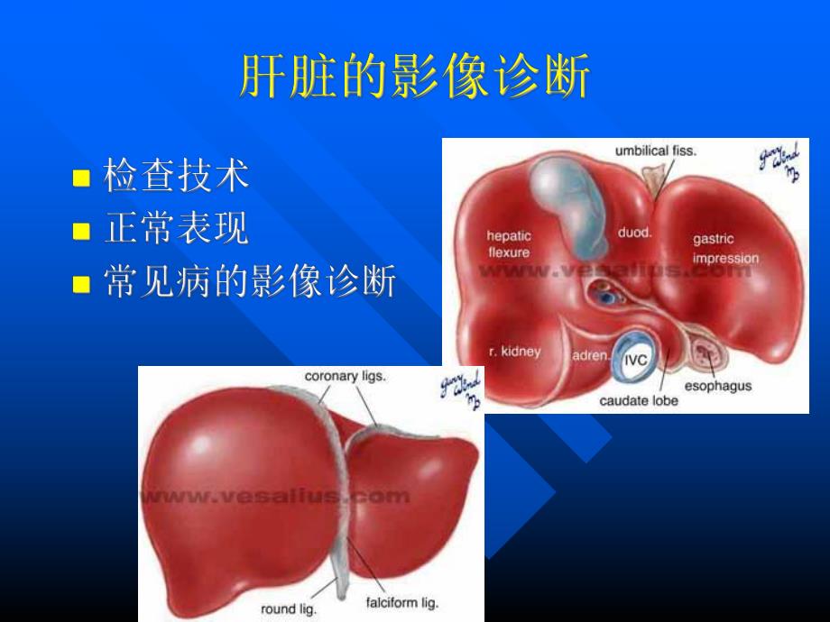 肝胆胰脾的影像诊断.ppt_第2页