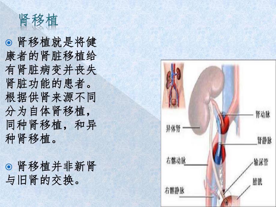 肾移植的护理.ppt_第3页