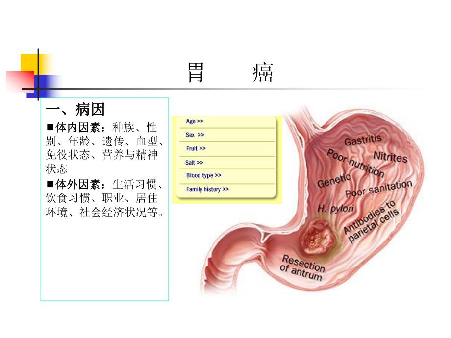 胃癌.ppt.ppt_第3页