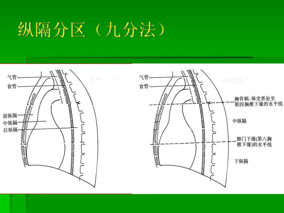 纵隔疾病.ppt_第3页