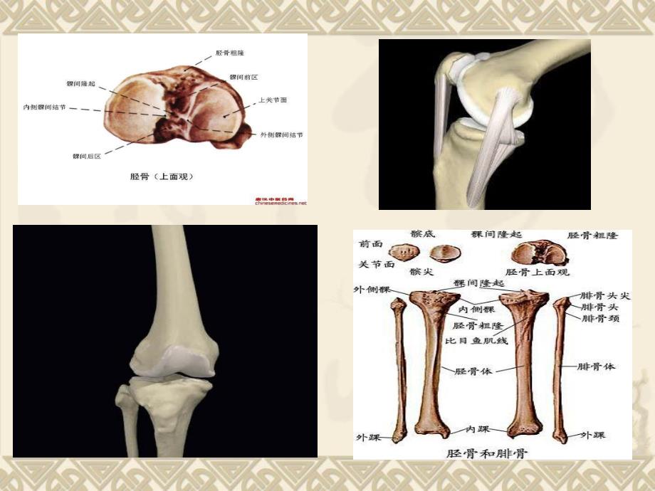 胫骨平台骨折最好的PPT.ppt_第3页