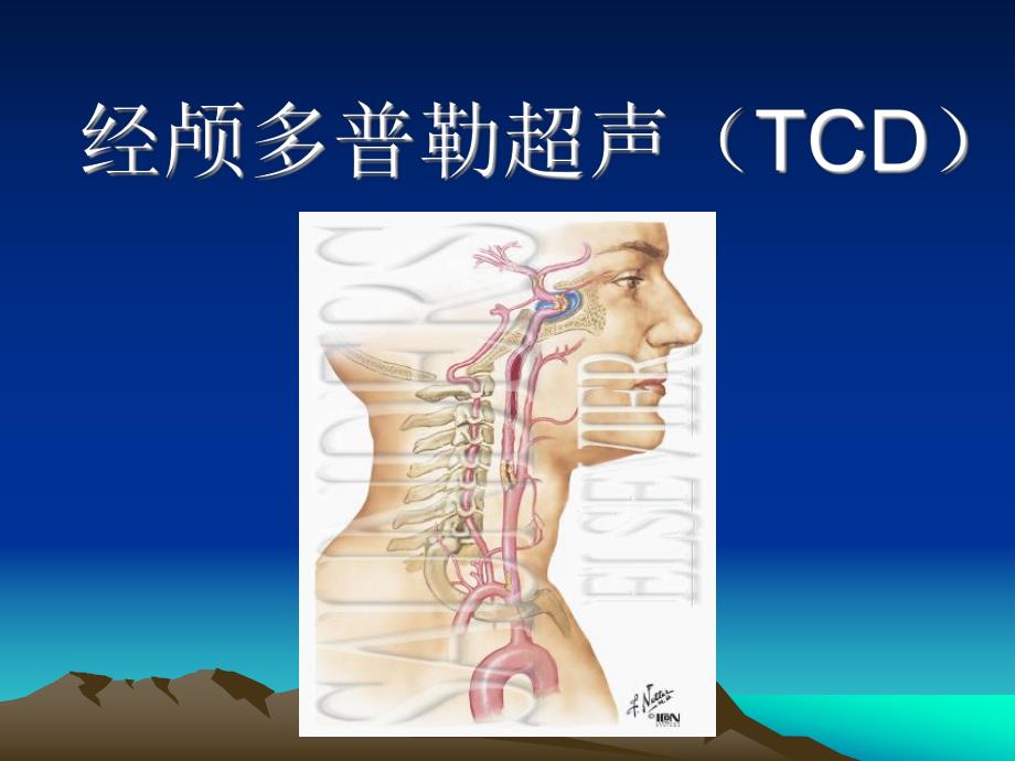 经颅多普勒超声(TCD).ppt_第1页