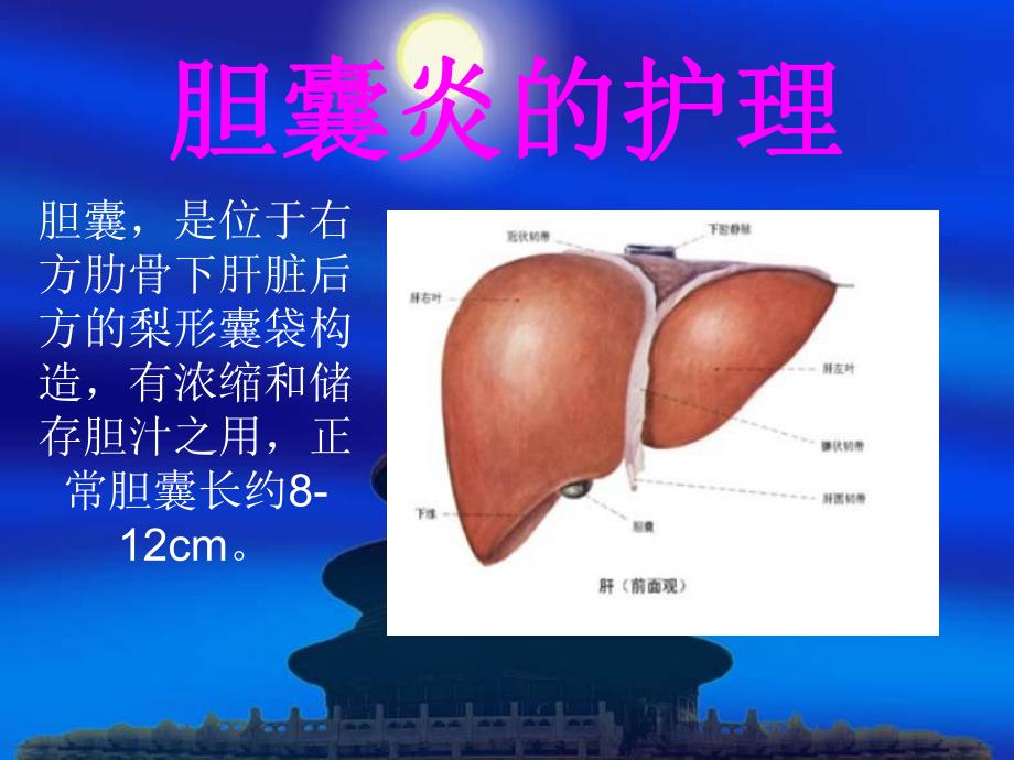 胆囊炎的护理.ppt_第2页