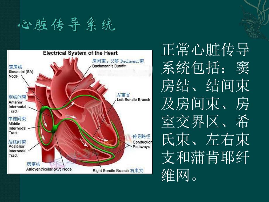 起搏器植入术后病人的护理.ppt.ppt_第3页