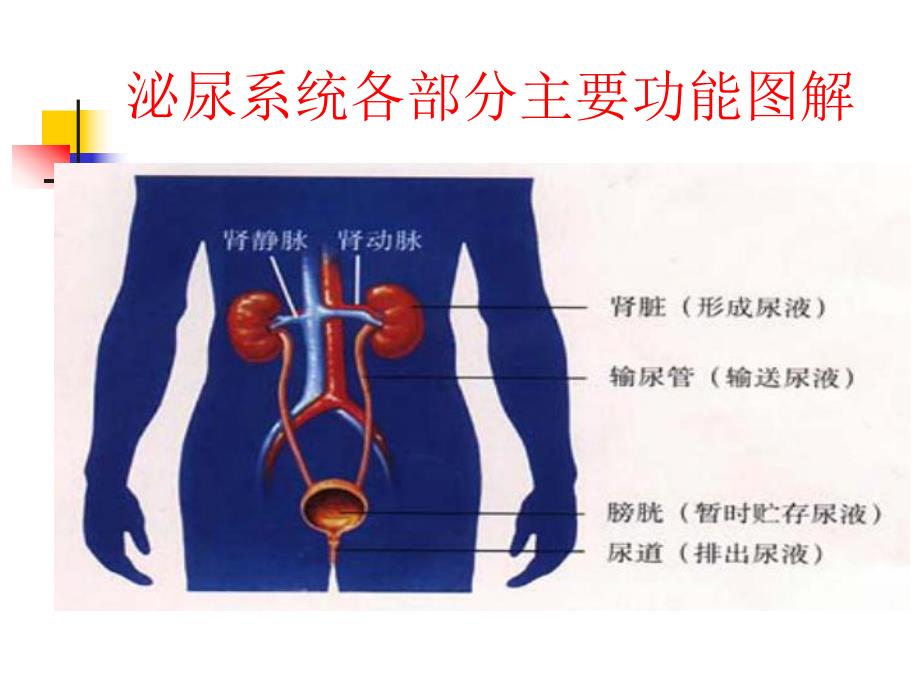 输尿管结石的护理查房.ppt_第3页