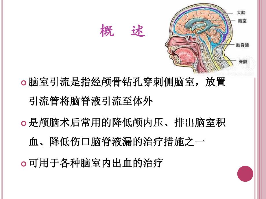 脑室引流管的护理ppt..ppt_第3页