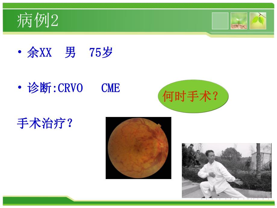 视网膜静脉阻塞.ppt_第3页