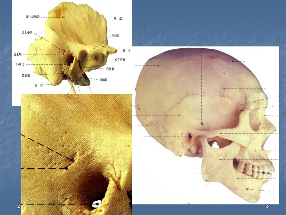 耳及颞骨的应用解剖.ppt_第3页