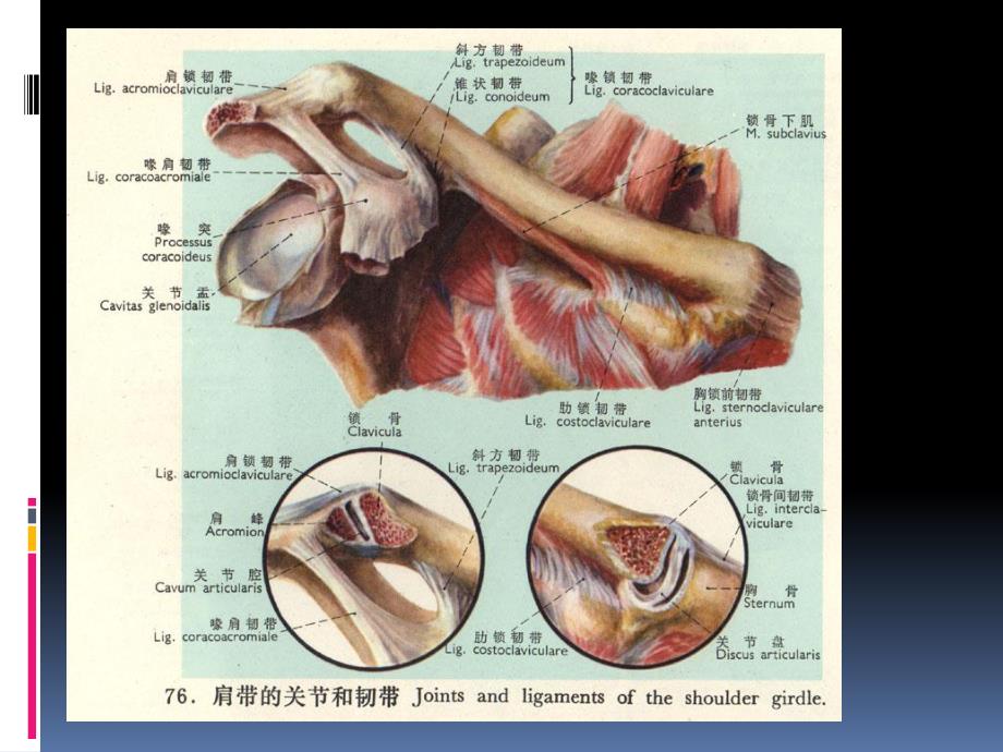 陈薇薇肩锁关节脱位的应用.ppt_第3页