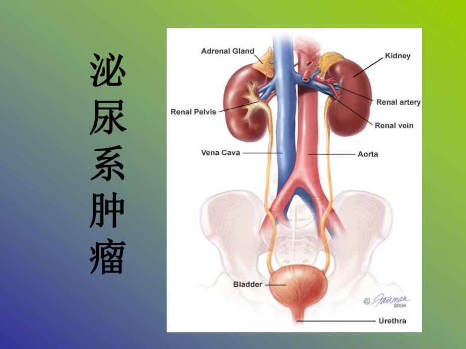 膀胱肿瘤.ppt_第1页