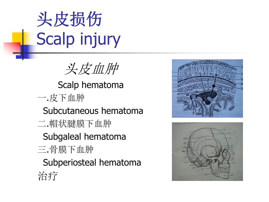 颅脑损伤教学幻灯片.ppt_第2页