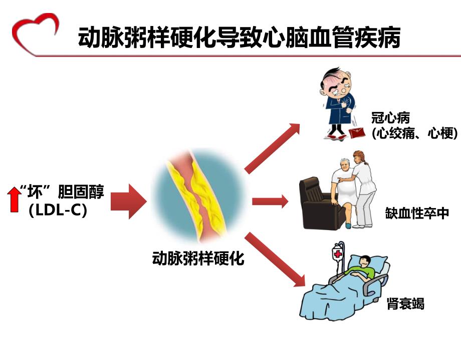 血脂健康教育.ppt_第3页