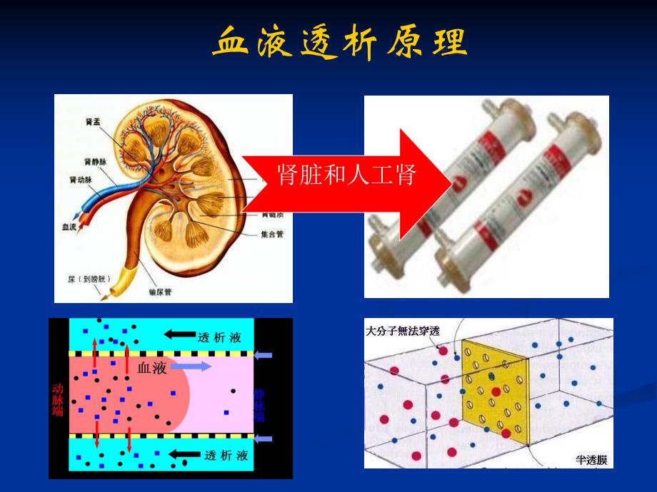 血液透析相关感染及防控.ppt_第3页