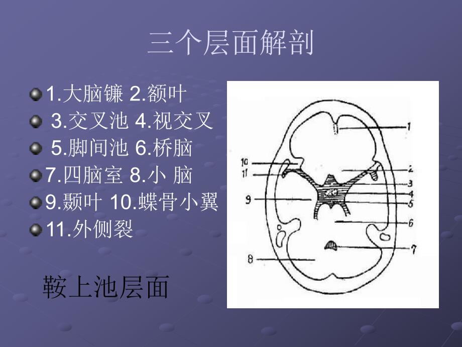 颅脑CT层面解剖.ppt_第2页