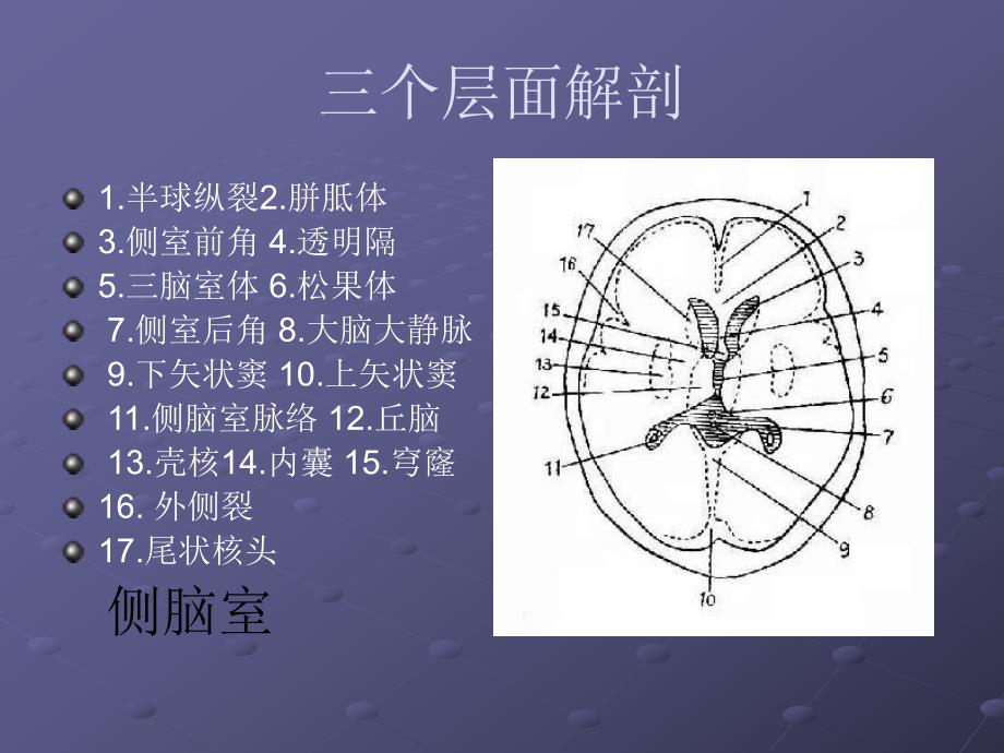 颅脑CT层面解剖.ppt_第3页