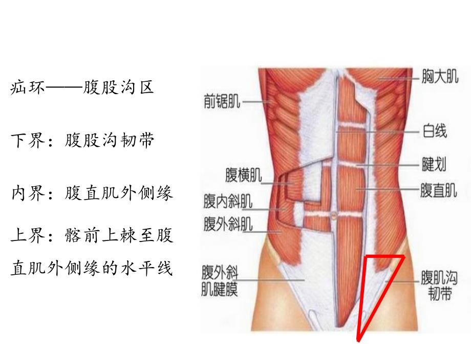 腹股沟疝.ppt_第2页