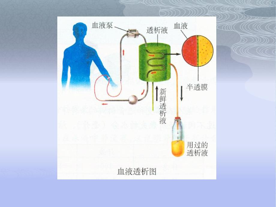 血液透析.ppt.ppt_第2页