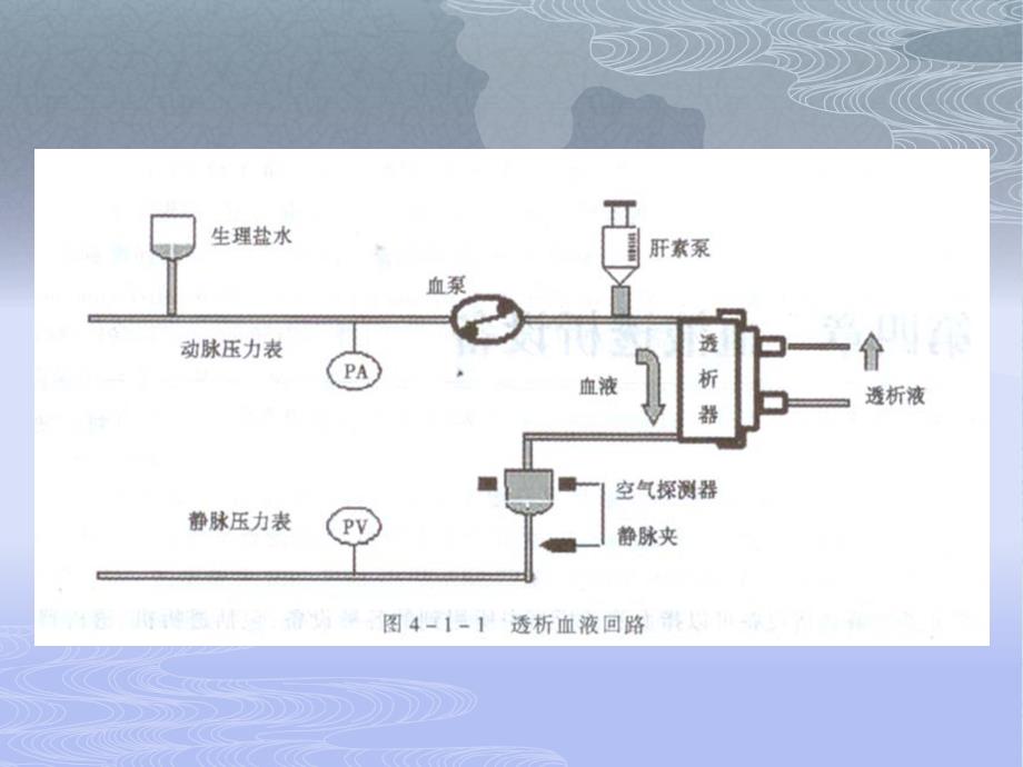 血液透析.ppt.ppt_第3页