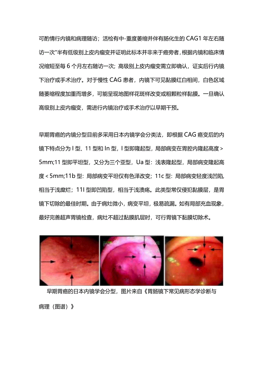 慢性萎缩性胃炎的癌变预防及治疗2024.docx_第3页