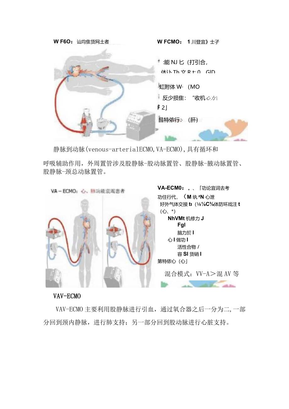 临床ECMO基本工作原理、工作模式及护理观察要点.docx_第2页