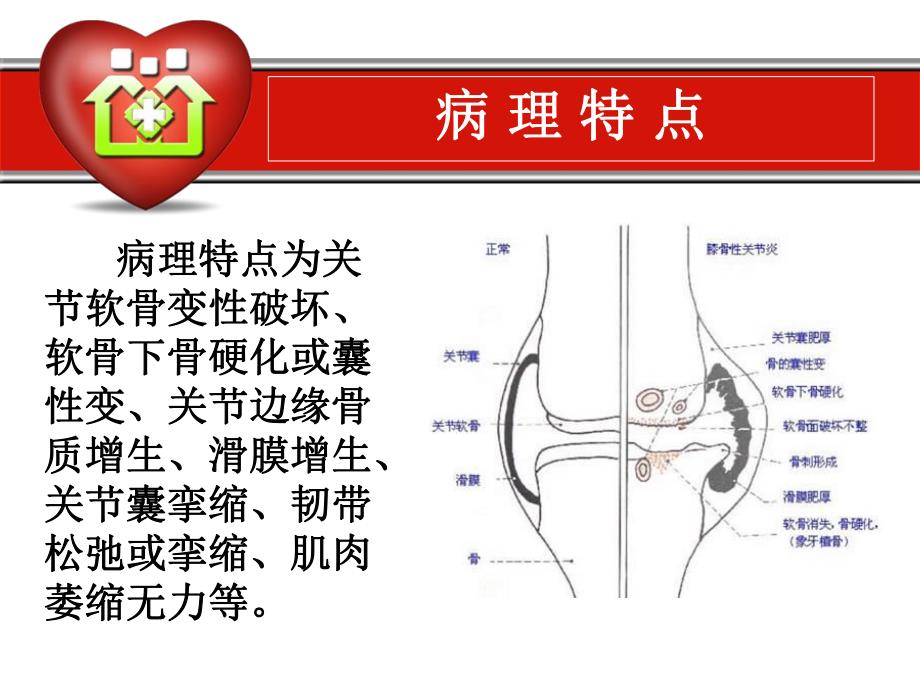 骨性关节炎的康复.ppt_第3页